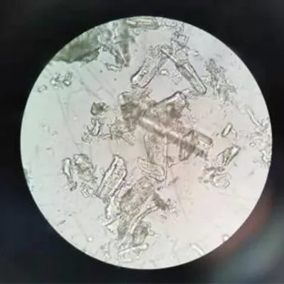 Antes de la homogeneización