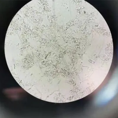 Después de la homogeneización a alta presión