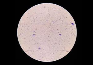 Disrupción celular de Lactobacillus